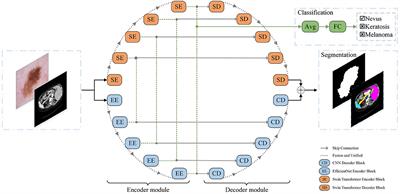 O-Net: A Novel Framework With Deep Fusion of CNN and Transformer for Simultaneous Segmentation and Classification